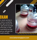 Bekam