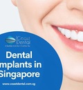 Dental implants - Replacing the missing tooth