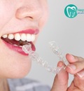 Affordable Implants Dentistry Sydney