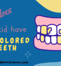 discoloured teeth